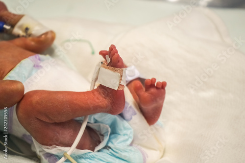 New born baby at the hospital in neonatal care  photo