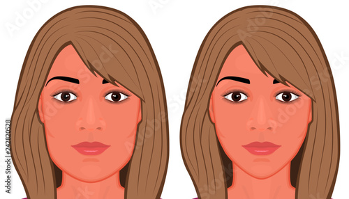 Vector illustration. A young white female face before and after plastic surgery - jaw reduction. Frontal view. For advertising of plastic surgery, medical and beauty publications
