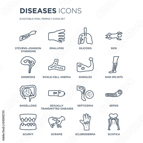 16 linear Diseases icons such as Stevens-Johnson syndrome, Smallpox, Scrapie, Scurvy, Sepsis, Sciatica, Siderosis modern with thin stroke, vector illustration, eps10, trendy line icon set.
