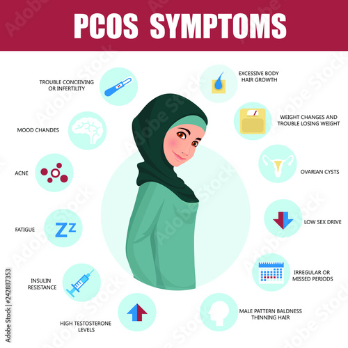 PCOS Symptoms infographic. Detailed vector Infographic. Women Health