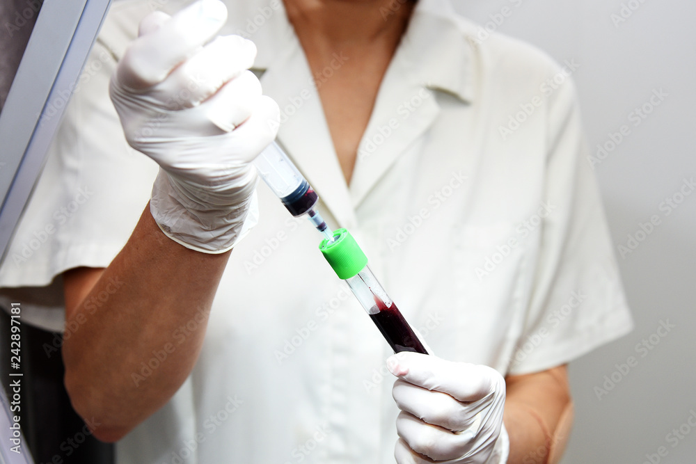 Plasmolifting. Injections for rejuvenation and skin regurgitation from human plasma. A modern beauty treatment.
Plasmolifting. Injections for rejuvenation and skin regurgitation from human plasma. A modern beauty treatment.