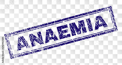 ANAEMIA stamp seal print with dirty style and double framed rectangle shape. Stamp is placed on a transparent background. Blue vector rubber print of ANAEMIA text with retro texture.