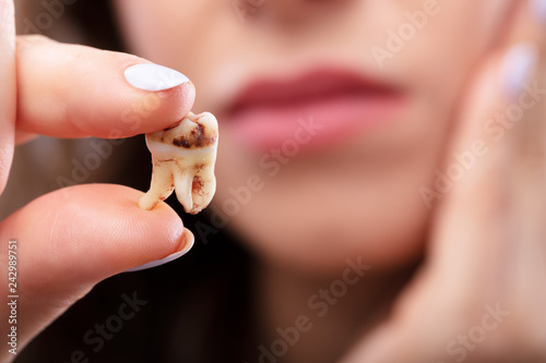 Canvas Print Woman Holding Decay Tooth
