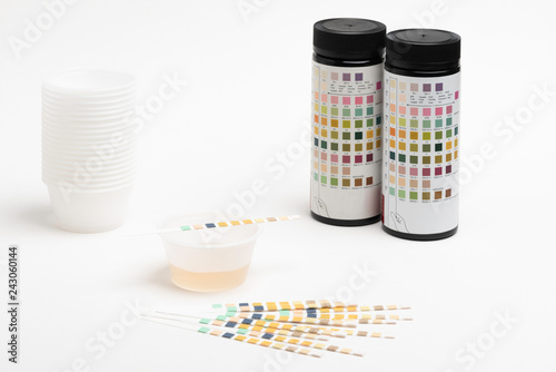 A setup for a urine test in a medical office with bottle container and an array of reagent strips along with sample urine in plastic containers set on white tabletop counter.