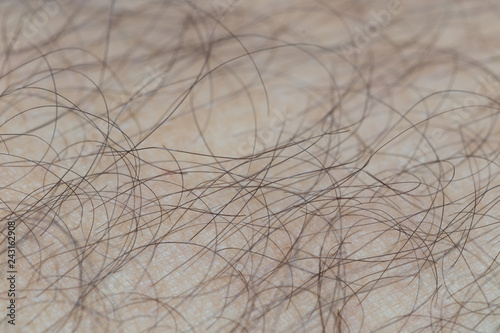 detail of human skin with hair, close-up