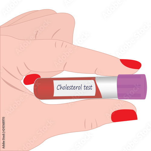 Blood cholesterol level laboratory test vector illustration