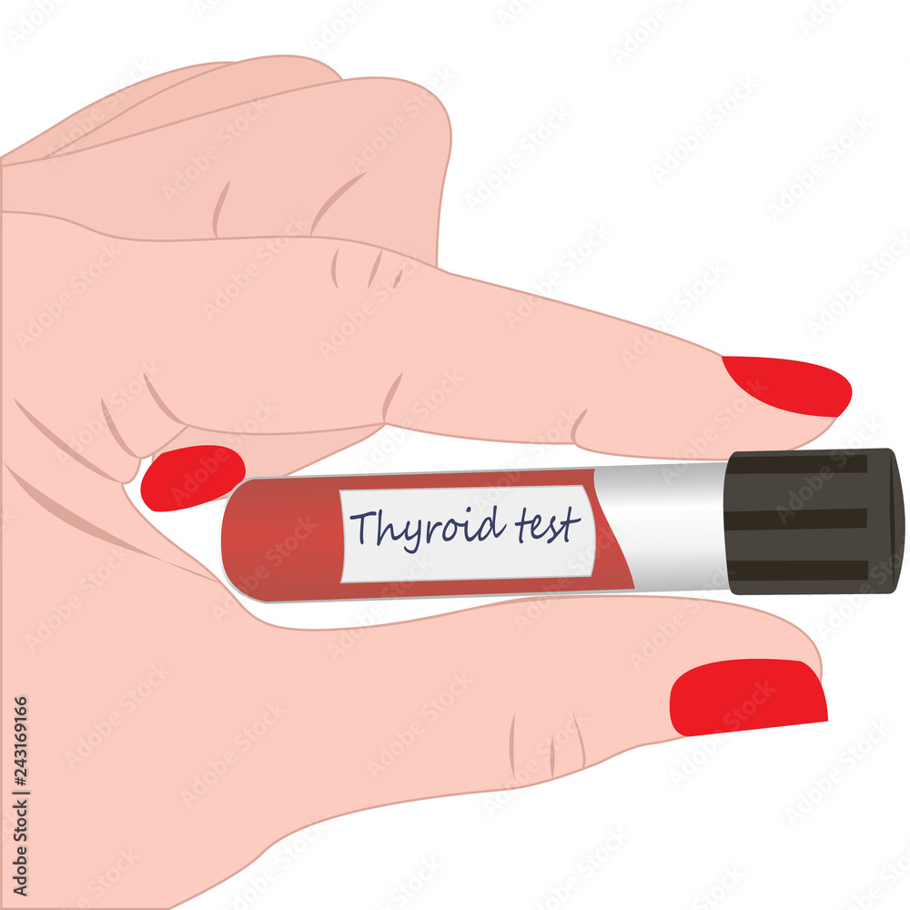 Thyroid test tube diagnosis technology Thyroid test tube diagnosis technology
