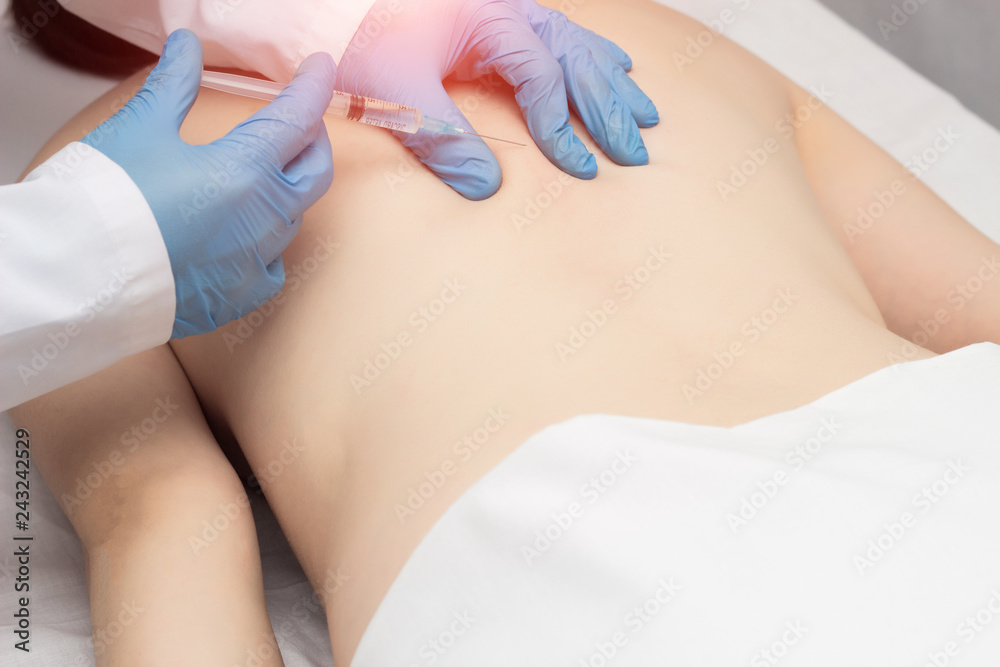 Naklejka premium Doctor injects trigger points on the patient s back to eliminate muscle spasm and pain, lumbago