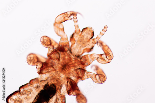 The head louse (Pediculus humanus capitis) is a parasite Live on the body, person or animal and live by sucking blood into food. photo