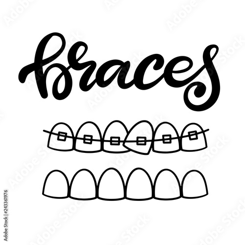 Lettering vector illustration about dental health care with the image of braces on teeth. EPS10. The image of the stages of orthodontic treatment for posters for dental clinic.