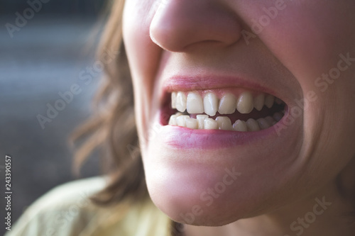Photo of crooked woman teeth