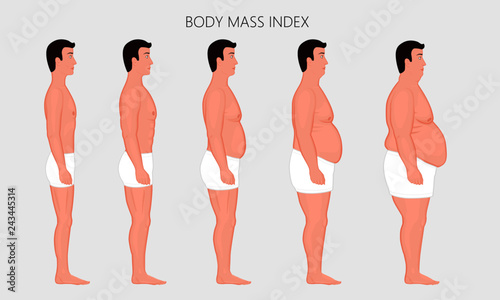 Vector illustration human body mass Index, European man from lack of weight to obesity Side view. For advertising of cosmetic, plastic procedures, stomach shunting, diet, medical publications
