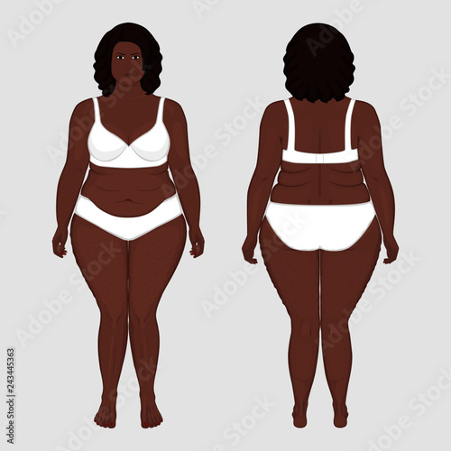 Vector illustration. Front, back views of naked African American woman in full growth. For advertising of cosmetic plastic procedures, stomach shunting, bypass, diet, medical publications
