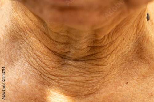 Senior woman's wrinkled neck, Black mole, Medicine, Close up & Macro shot, Selective focus, Body part, Healthcare concept photo