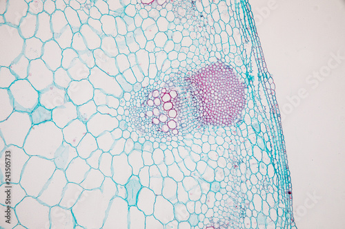 Obraz na płótnie Cross-section Dicot, Monocot and Root of Plant Stem under the microscope for classroom education