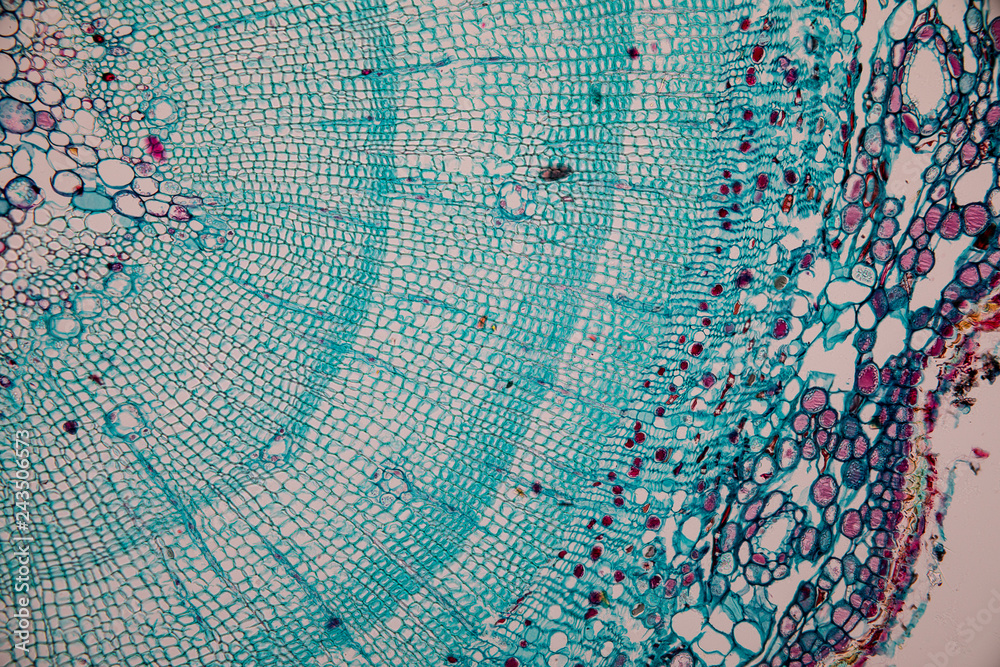 Cross-section Dicot, Monocot and Root of Plant Stem under the ...