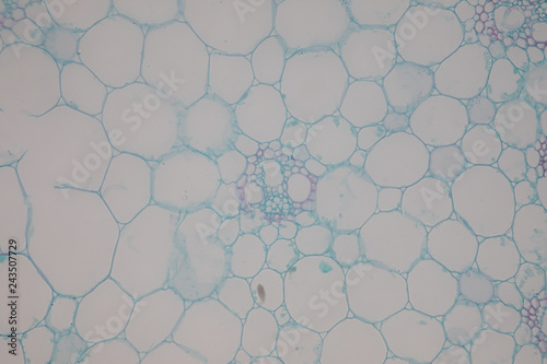 Cross-section Dicot, Monocot and Root of Plant Stem under the microscope for classroom education.  photo