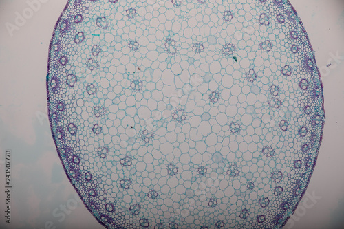 Cross-section Dicot, Monocot and Root of Plant Stem under the microscope for classroom education.  photo