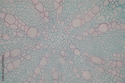Cross-section Dicot, Monocot and Root of Plant Stem under the microscope for classroom education.  photo