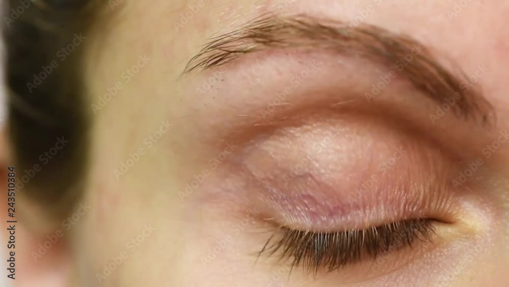 Girl removes a contact lens for vision from a eye.