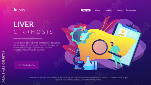 Doctors examining huge liver with magnifier and microscope. Cirrhosis, cirrhosis of the liver and liver disease concept on white background. Website vibrant violet landing web page template.