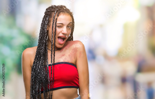 Young braided hair african american with pigmentation blemish birth mark over isolated background winking looking at the camera with sexy expression, cheerful and happy face.