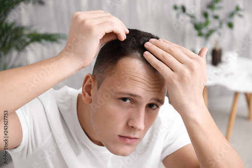 Man with hair loss problem at home