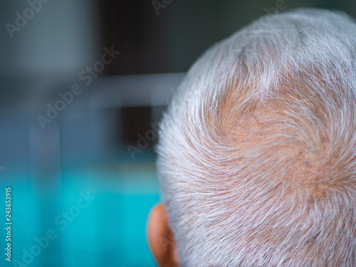 Close-up of head senior man patient in room in the hospital.