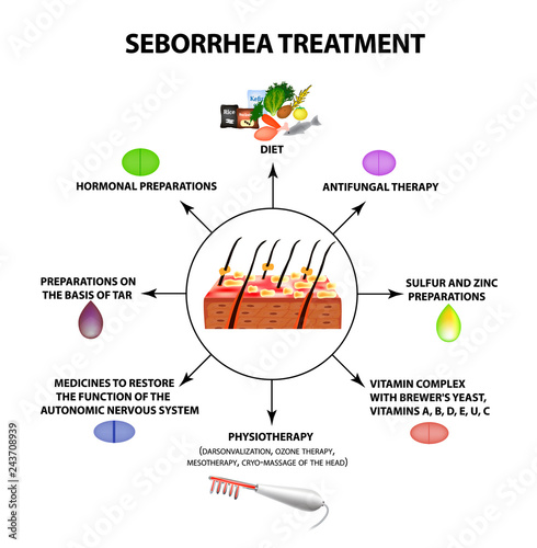 Treatment of seborrhea. Seborrhea skin and hair. Dandruff, seborrheic dermatitis. Baldness, hair growth, baldness. Anatomical structure. Infographics. Vector illustration on isolated background.