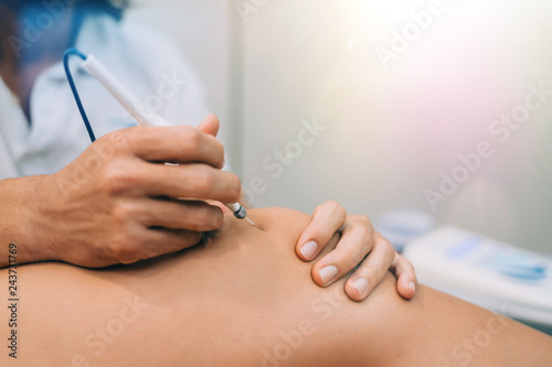 Electroacupunture dry needling needle connecting machine to needles used by acupunturist on patient for acupunture guided by EPI Intratissue Percutaneous Electrolisis. photo