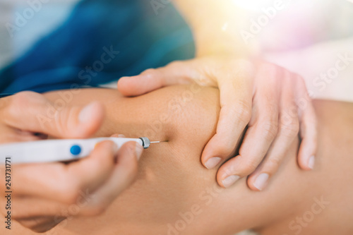 Electroacupunture dry needling needle connecting machine to needles used by acupunturist on patient for acupunture guided by EPI Intratissue Percutaneous Electrolisis.