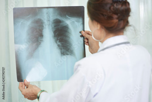Rear view of female lung specialist checking chest x-ray of patient