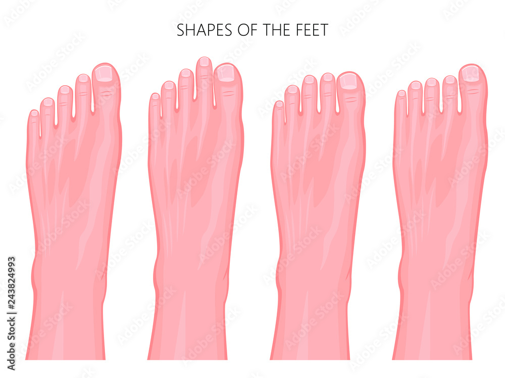 Most common types of human forefoot shapes with different variations of