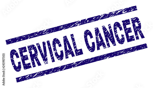 CERVICAL CANCER seal print with grunge style. Blue vector rubber print of CERVICAL CANCER text with retro texture. Text tag is placed between parallel lines.
