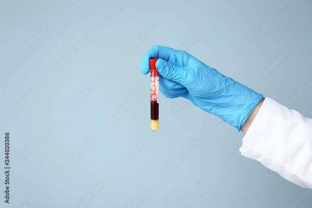 Hand of laboratory assistant holding test tube with blood sample on color background Hand of laboratory assistant holding test tube with blood sample on color background