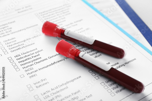 Blood samples on document w...