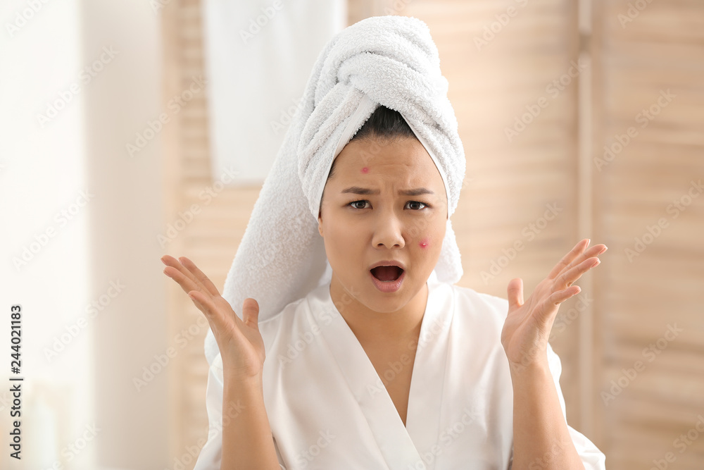 Portrait of shocked Asian woman with acne problem in bathroom Portrait of shocked Asian woman with acne problem in bathroom