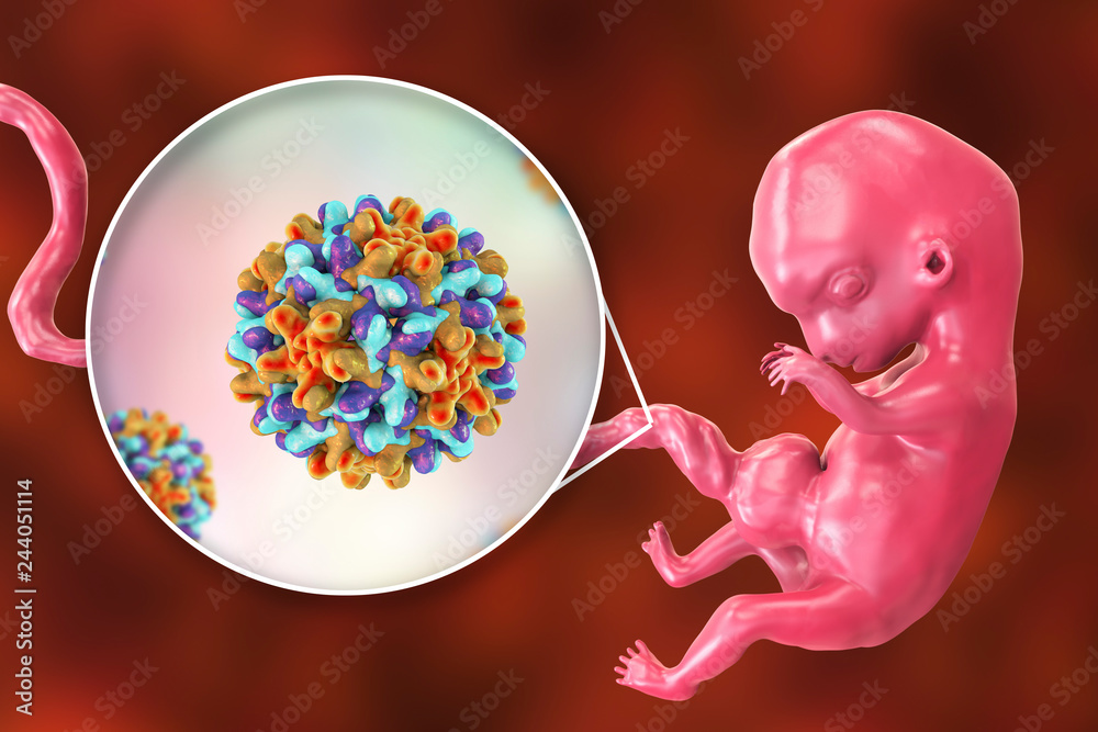 Transplacental transmission of Hepatitis B viruses to human embryo, 3D
