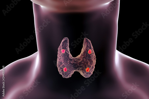 Parathyroid glands and thyroid gland anatomy, 3D illustration photo