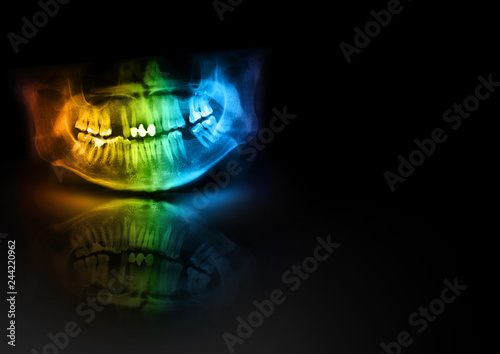 Panoramic radiograph is a scanning dental X-ray of the upper jaw maxilla and lower jawbone mandible. Blank black empty medical horizontal background template for text