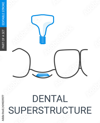 Dental superstructure installation