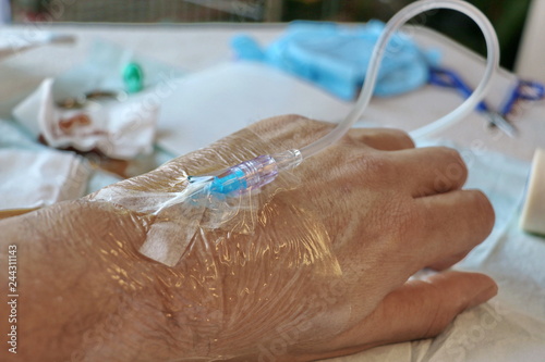 Pose d'une perfusion