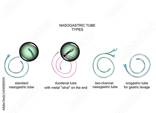 types of nasogastric tubes photo