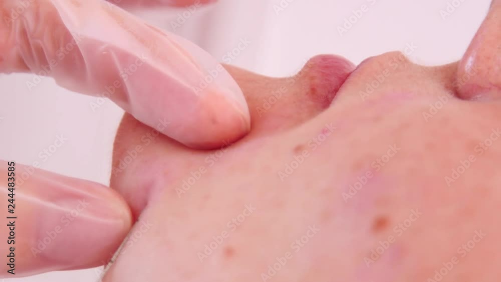 Needle of syringe is injected subcutaneously to fill injection fillers Needle of syringe is injected subcutaneously to fill injection fillers