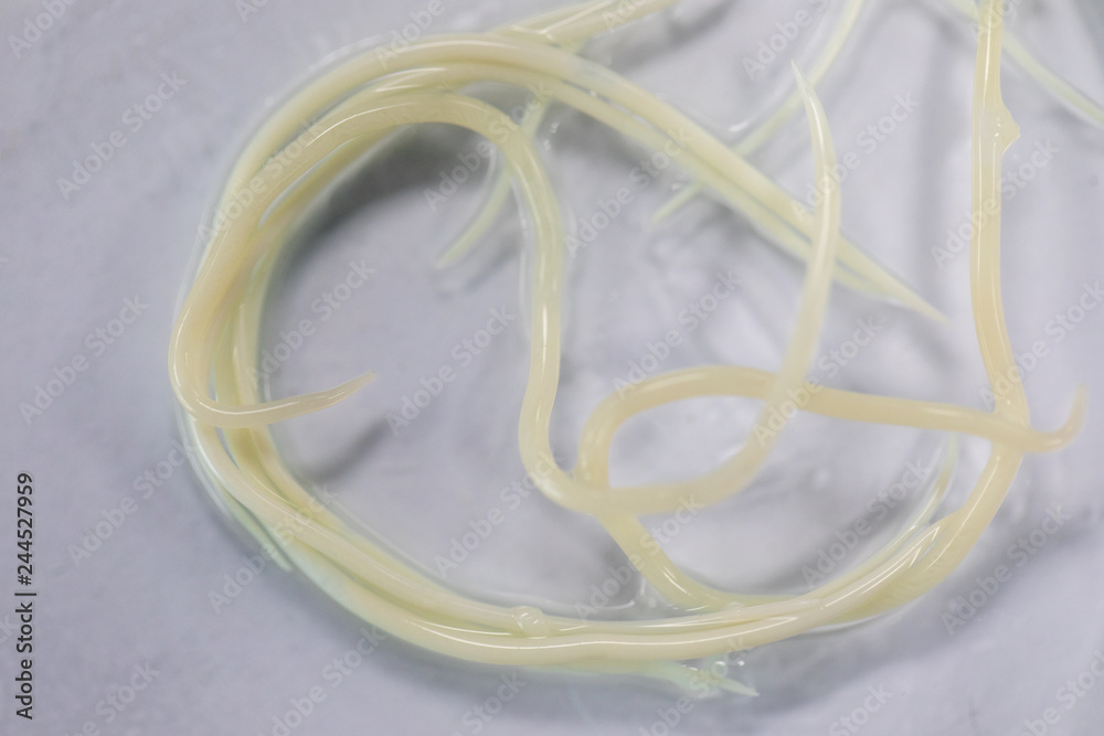 Ascariasis is a disease caused by the parasitic roundworm Ascaris ...