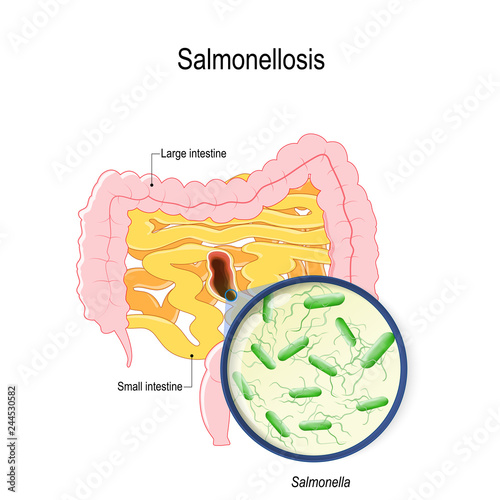 salmonellosis. human intestines and bacterium that cause this disease photo