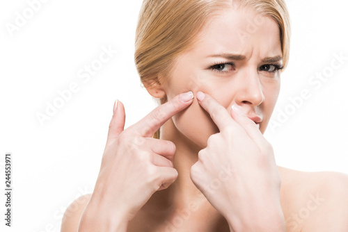 unhappy young woman squeezing pimple on face and looking at camera isolated on white