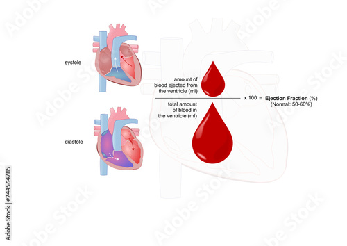 ejection fraction: measure of the heart functionality photo