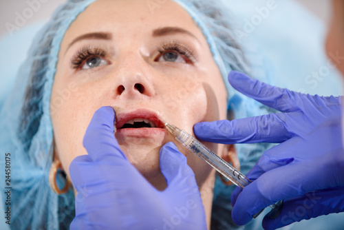 girl do plastic operation in medical clinic; doctor does lip augmentation surgery; injecting operation on lips