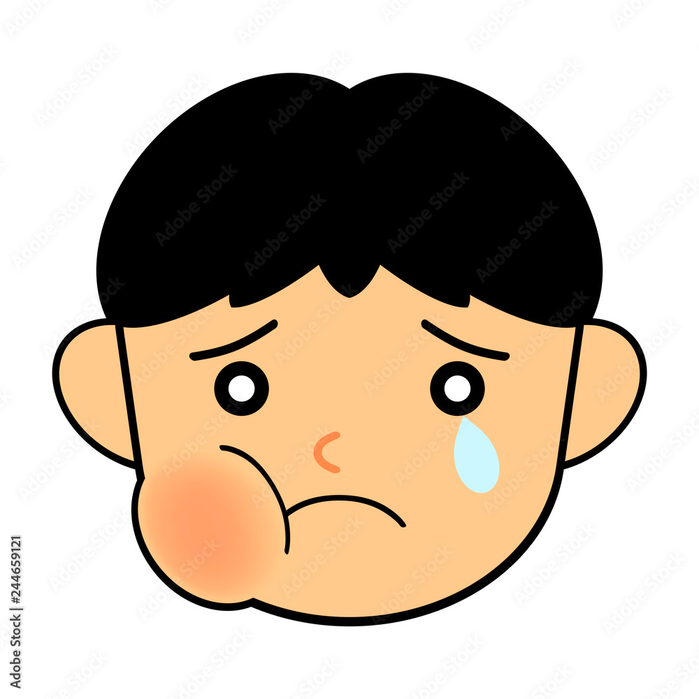 ほっぺたの腫れた子供 ほっぺたの腫れた子供